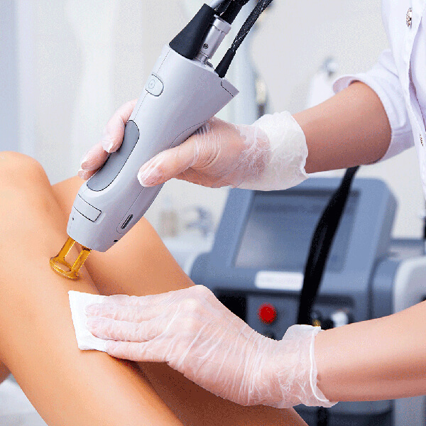 Epilare cu laser Candela Gentle Max Pro Alexandrite
