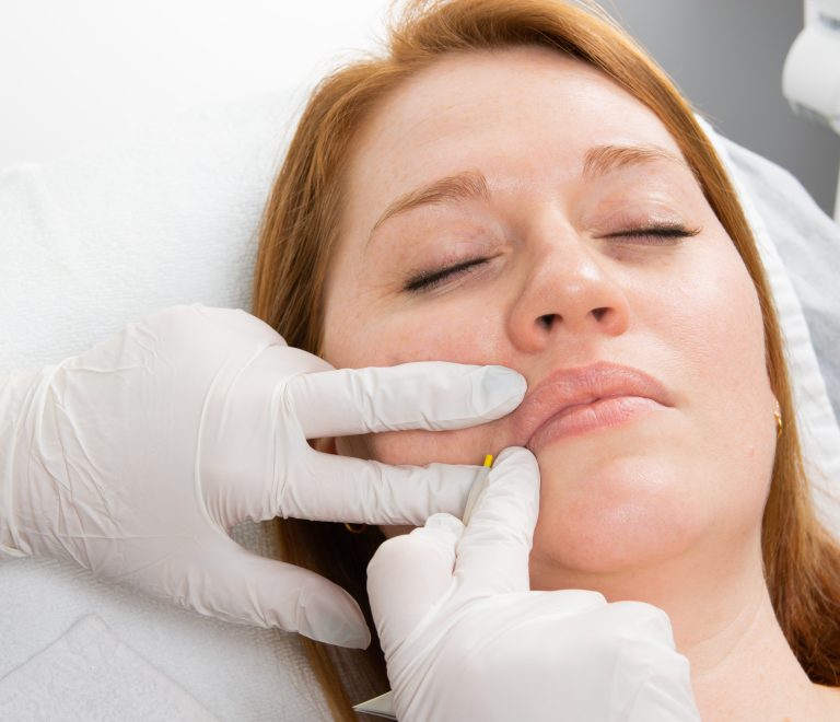 Electro epilare cu Apilus XCell Pro